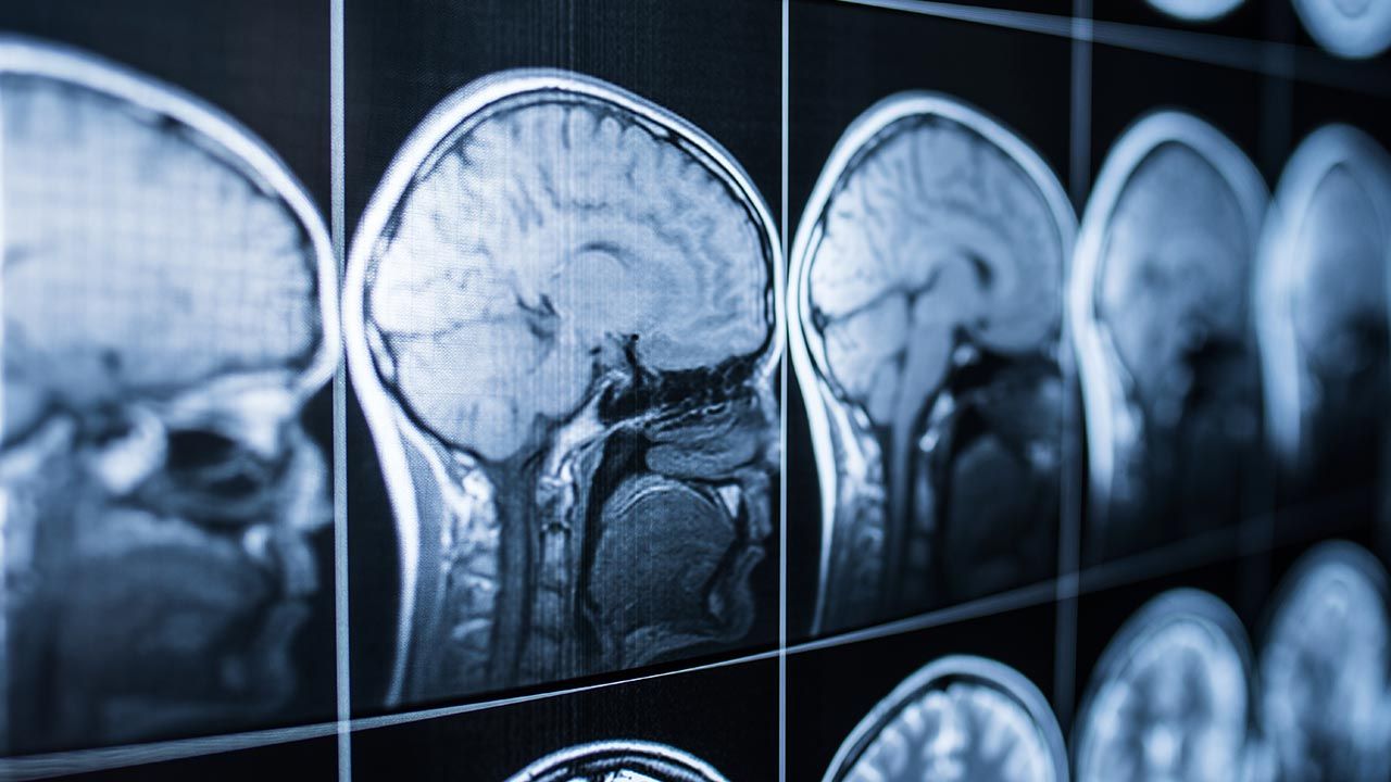 Mózg jest organem tajemniczym i jego poznawanie nigdy się nie skończy (fot. Shutterstock/Jalisko)