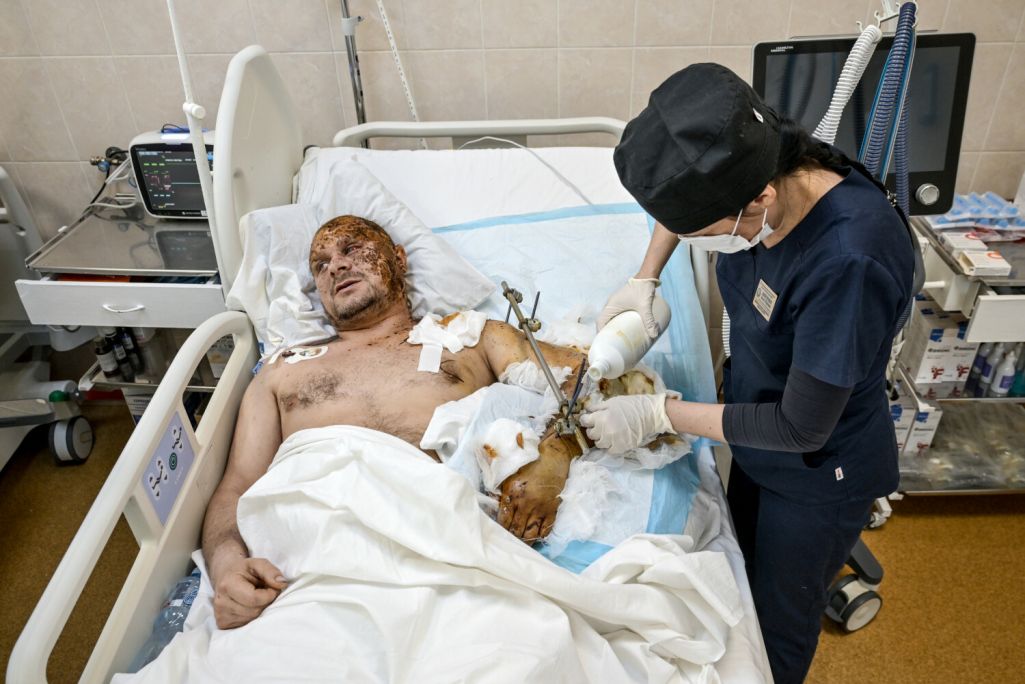 Медработнік даглядае параненага салдата з пазыўным Механік у палаце аддзялення інтэнсіўнай тэрапіі Дняпроўскай абласной клінічнай больніцы імя Іллі Мечнікава пасля ранення на фронце. Дняпро, Украіна. 14 сакавіка 2025 года. Фота: Dmytro Smolienko / Ukrinform / East News