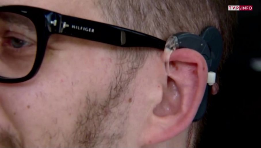Implanty słuchowe wszczepiane są w Kajetanach